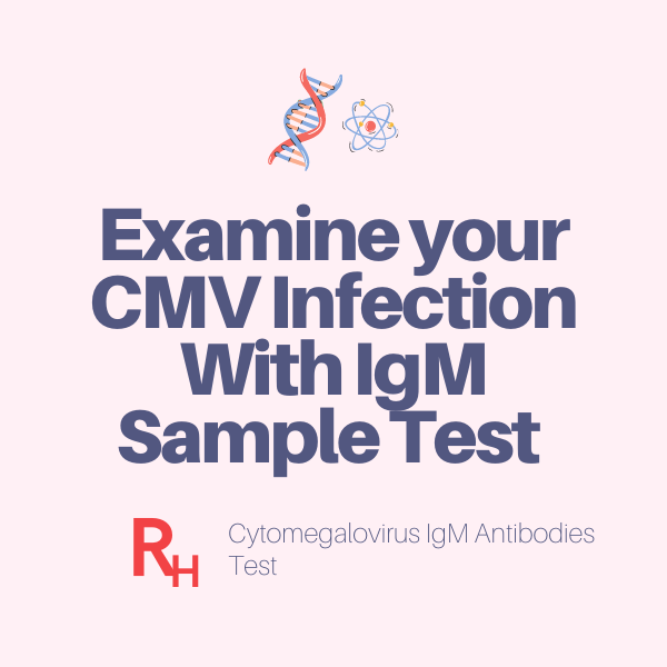 Cytomegalovirus IgM Antibodies Test